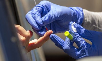 Virus Outbreak Antibody Tests