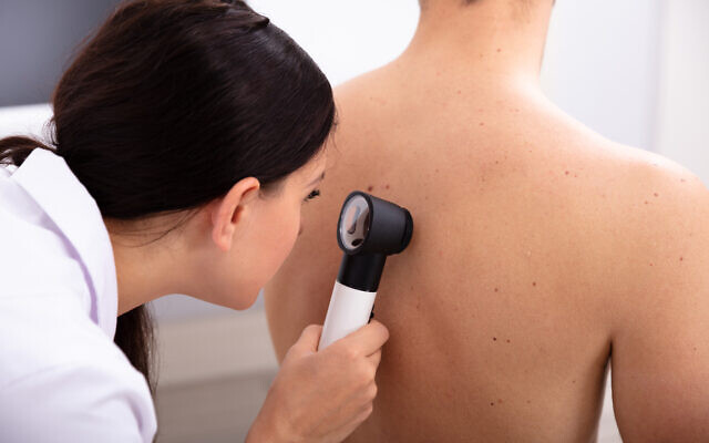 Doctor Examining Pigmented Skin On Man’s Back