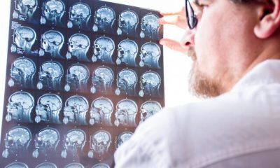 Doctors evaluation results of magnetic resonance imaging of brain in hospital concept photo. Neurologist in glasses keeps hand on glass of negatoscope MRI scan and examines structure of brain tissue