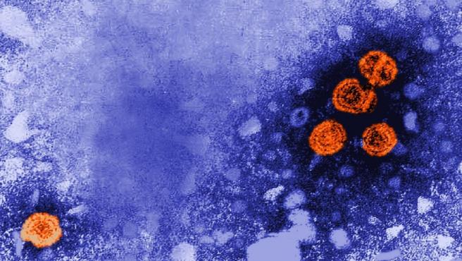 imagen-de-microscopia-electronica-de-transmision-coloreada-digitalmente-revela-la-presencia-de-viriones-de-la-hepatitis-b-de-color-naranja.r_d.720-507