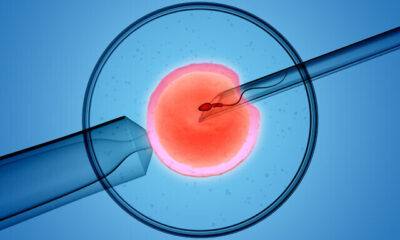 3D rendering of the icsi(intracytoplasmic sperm injection) process – in which a single sperm is injected directly into an egg