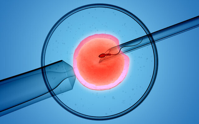3D rendering of the icsi(intracytoplasmic sperm injection) process – in which a single sperm is injected directly into an egg