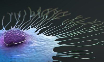 Scientific illustration of a migrating breast cancer cell – 3d illustration