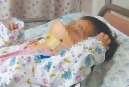 En un extraño procedimiento, médicos israelíes salvaron de una parálisis a un niño de Gaza